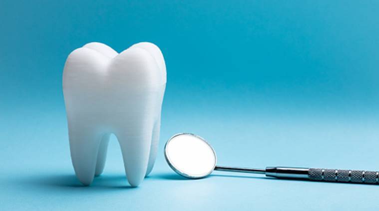 indirect composite veneers