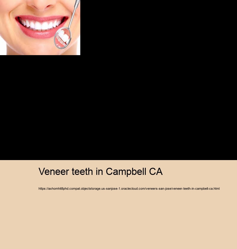 veneer teeth in Campbell CA resin teeth veneers