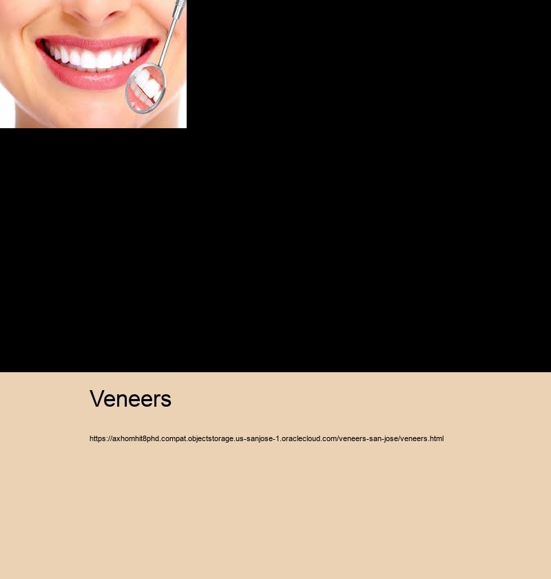 Veneers bl1 veneers